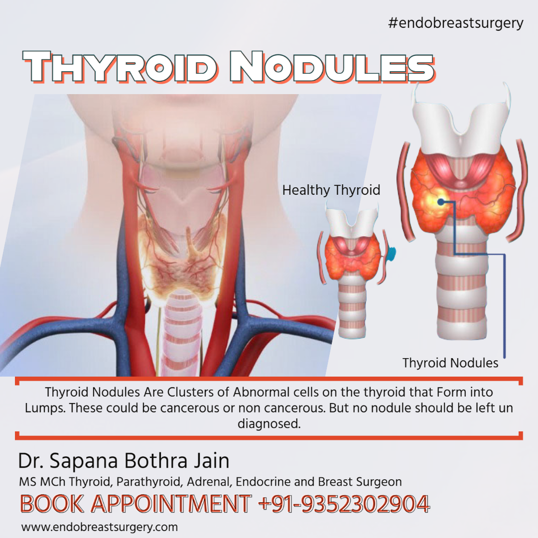 thyroid noduls surgeon jaipur